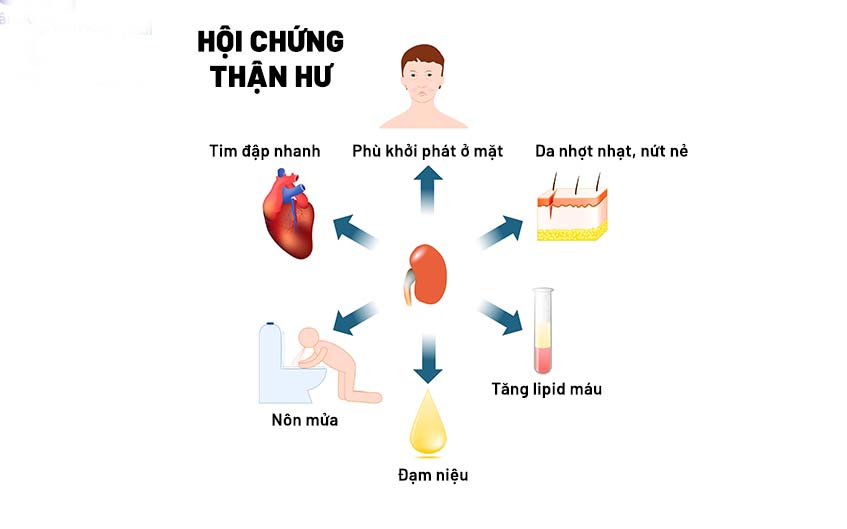 trieu-chung-cua-hoi-chung-than-hu